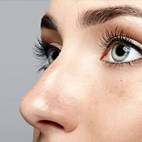 Rhinoplasty in Forest Hills